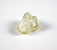 Embryologic House (stereolithography model)
