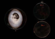Eye