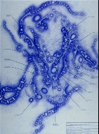 Three Mile High Club, Metastasis
